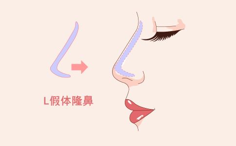 激光洗纹身术后注意事项