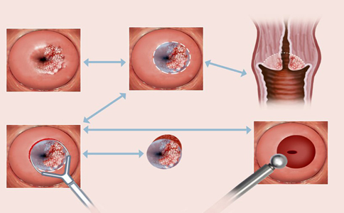 Ů�Թ����������ʳ���� ��������