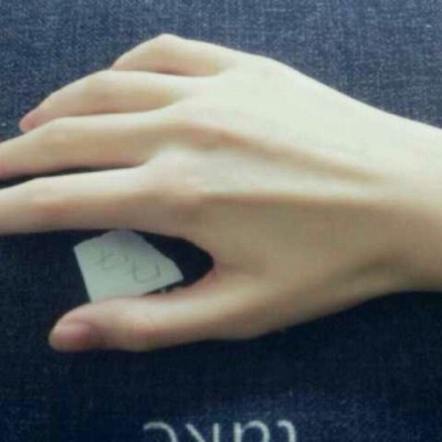 �ֿظ���΢�Ŵ�ͼ